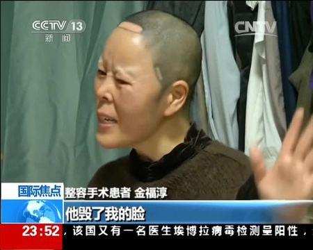 韩国人割双眼皮6千,向中国人收费竟是原价87倍