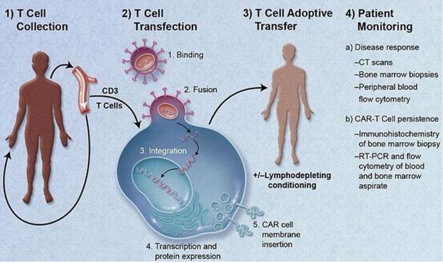 CAR-T细胞治疗:血液肿瘤治疗大放异彩